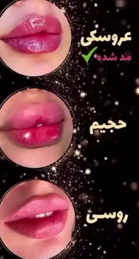 جشنواره فیلر لب  کانتورینگ ژل بوتاکس هایفوتراپی|خدمات آرایشگری و زیبایی|تهران, دانشگاه شریف|دیوار