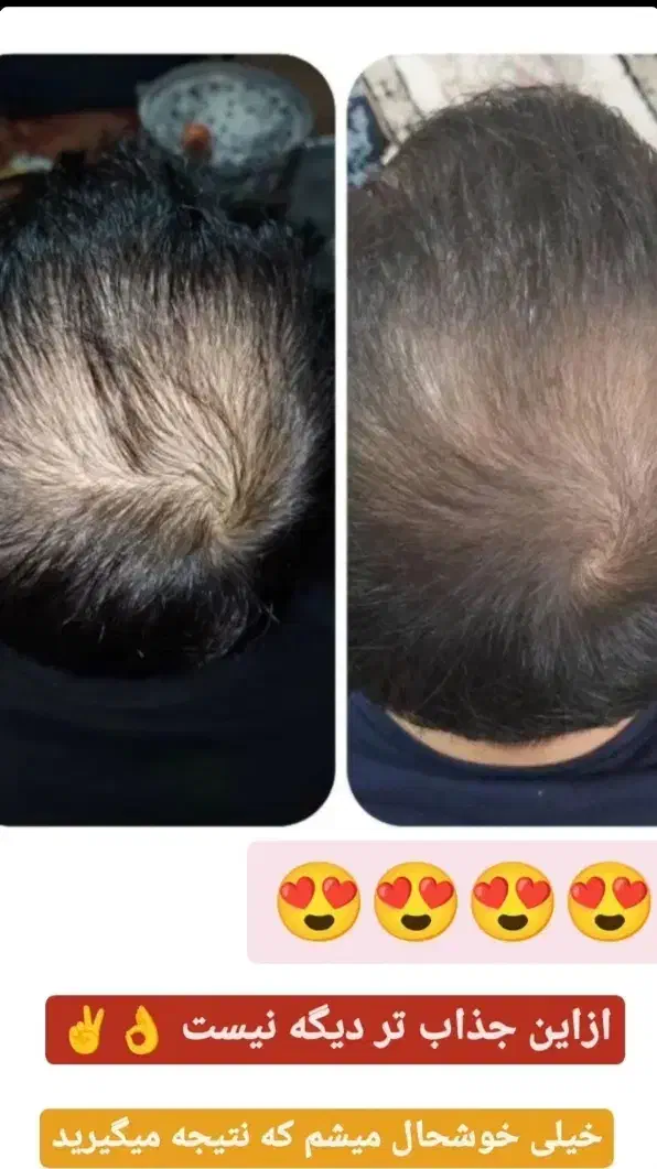 مراقبتی پوست و مو|آرایشی، بهداشتی، درمانی|سنندج, |دیوار