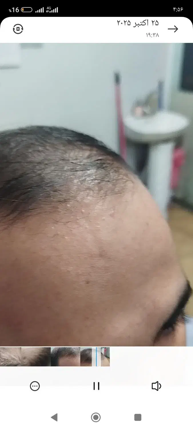 پودر جذاب حجم دهنده و حالت دهنده مو|آرایشی، بهداشتی، درمانی|مشهد, نیزه|دیوار