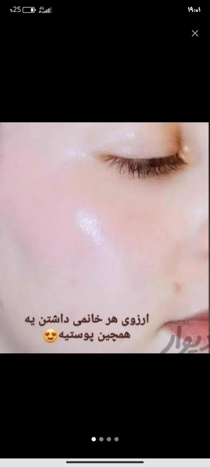 فرمول کرم سفیدی دست و پا وصورت|آرایشی، بهداشتی، درمانی|زابل, |دیوار