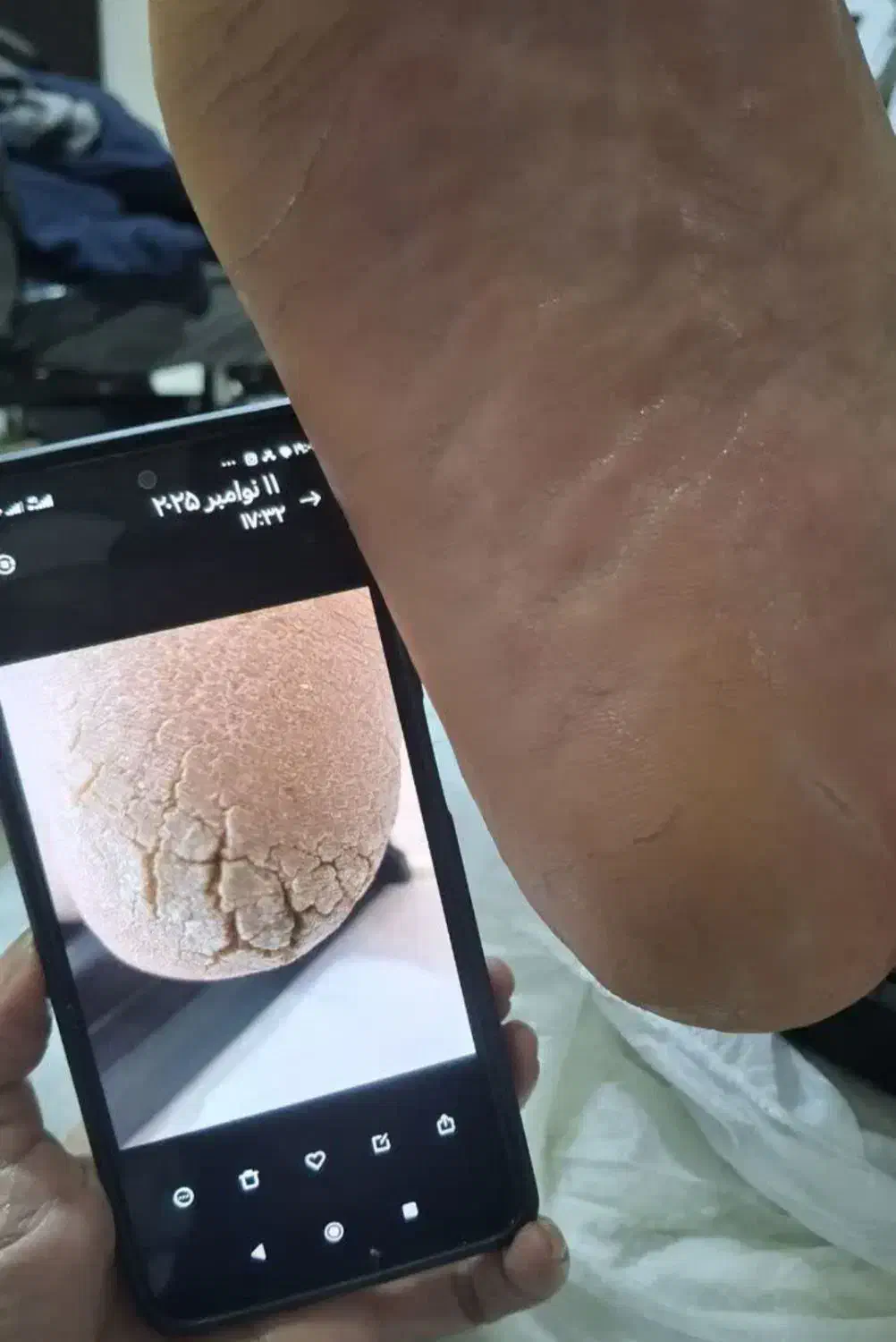 پدیکور درمانی آقایان و بانوان|خدمات آرایشگری و زیبایی|قم, دورشهر|دیوار