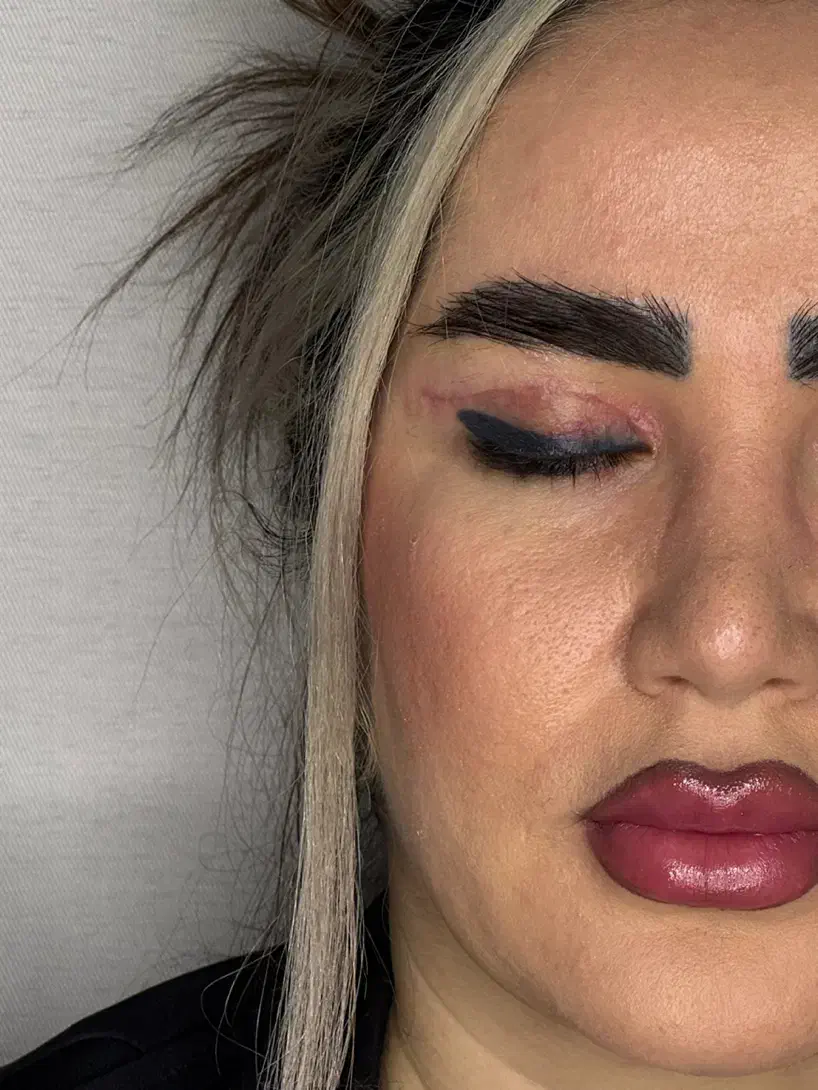 انواع جراحی های زیبایی صورت و بدن|خدمات آرایشگری و زیبایی|رشت, آتشگاه|دیوار