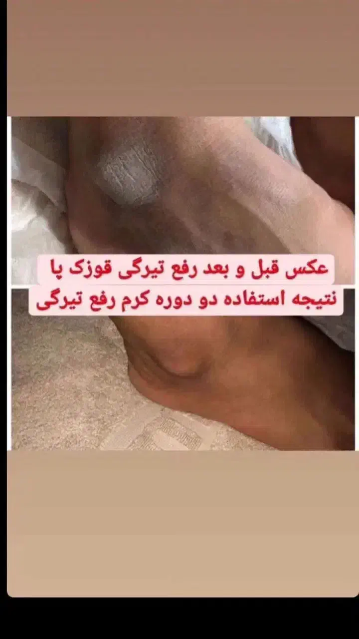 کرم روشن کننده و ضد چین و چروک گاتیو اصل اصل|آرایشی، بهداشتی، درمانی|اهواز, منبع اب|دیوار