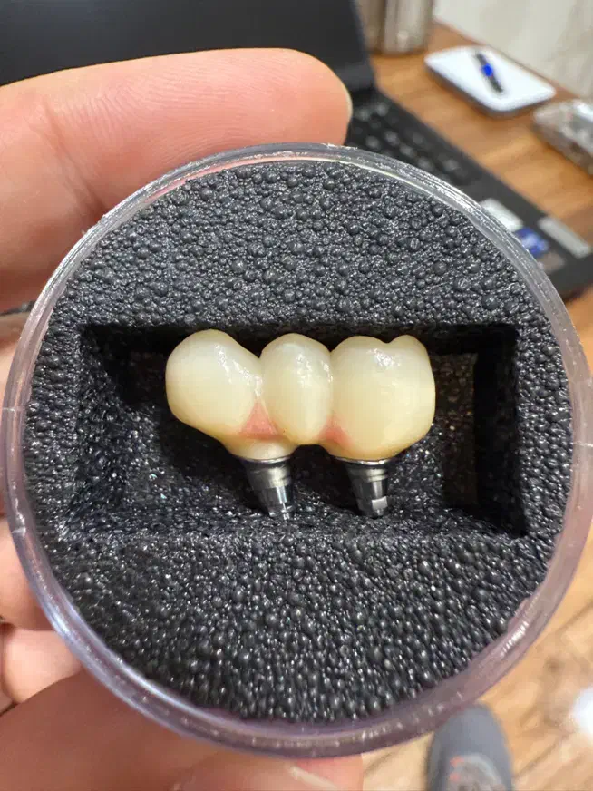 اموزش حضوری دورهای طراحی دیجیتال دندانسازی اگزوکد|خدمات آموزشی|شیراز, زرگری|دیوار