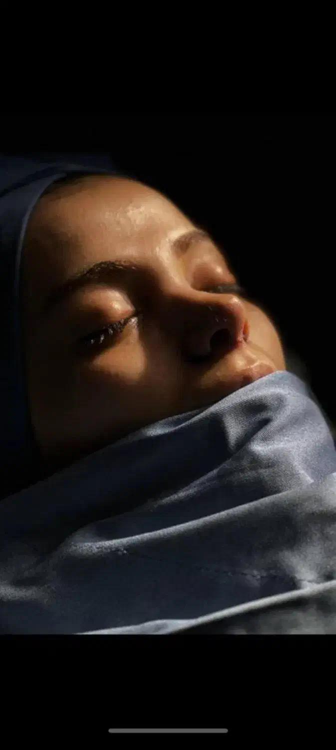 جنشواره عمل بینی|خدمات آرایشگری و زیبایی|حمیدیه, |دیوار