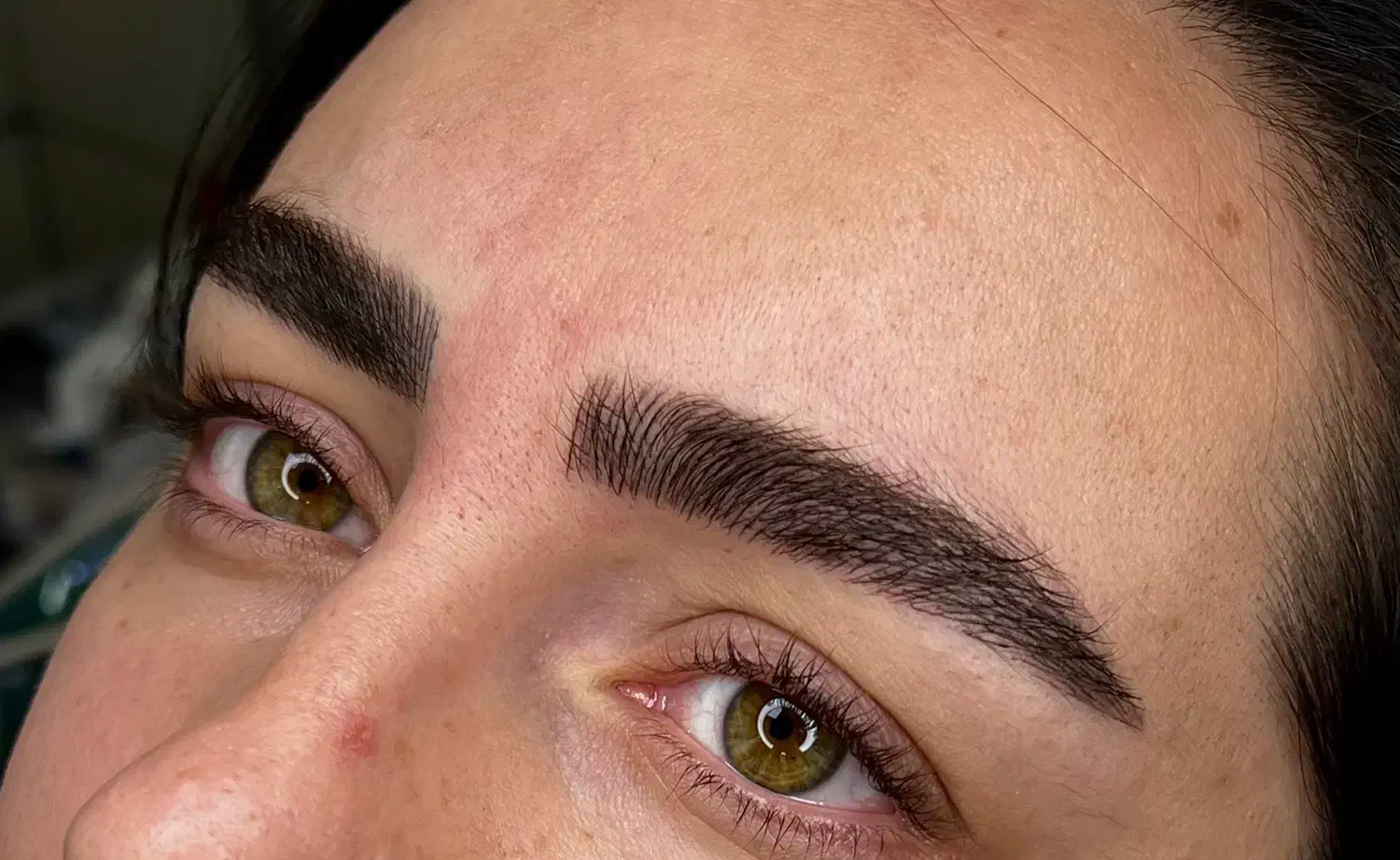 مدل برای فیبروز و میکروبلیدینگ|خدمات آرایشگری و زیبایی|خوی, |دیوار