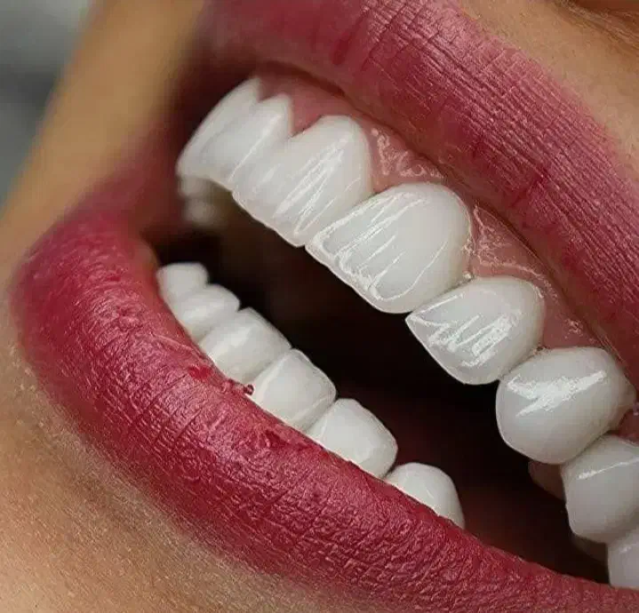 سلامت دندان مهمترین عنصر آراستگی صورت|خدمات آرایشگری و زیبایی|کرمان, |دیوار