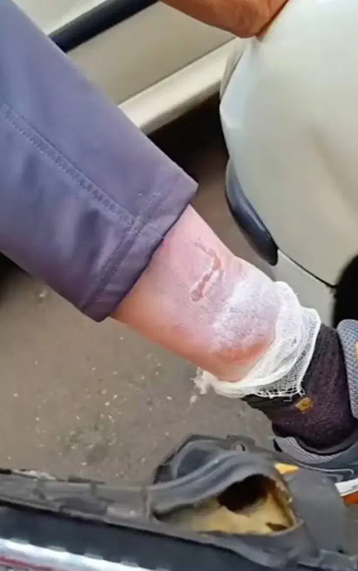 محافظ رادیات بخاری ۲۰۶ /۲۰۷/رانا/رانا پلاس|قطعات یدکی و لوازم جانبی|فومن, |دیوار