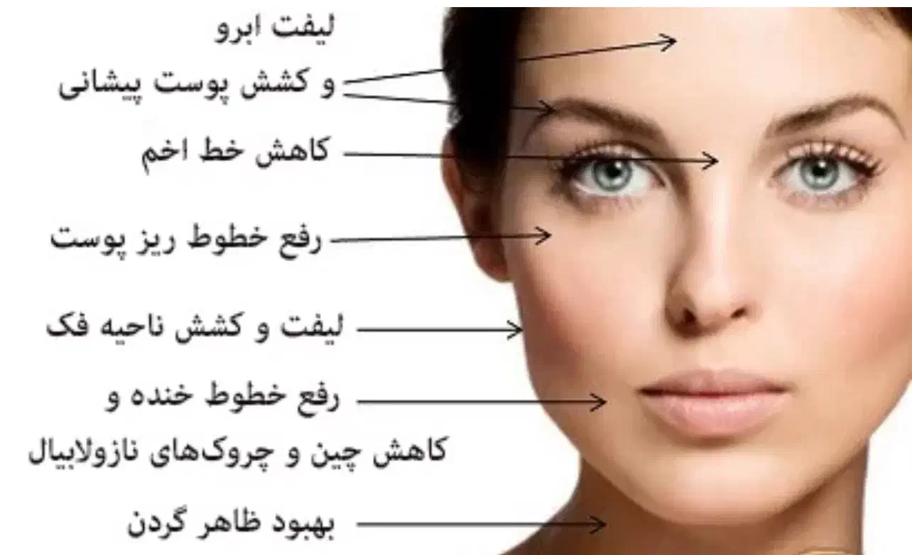 هایفو تراپی صورت شب یلدا|خدمات آرایشگری و زیبایی|سیرجان, |دیوار