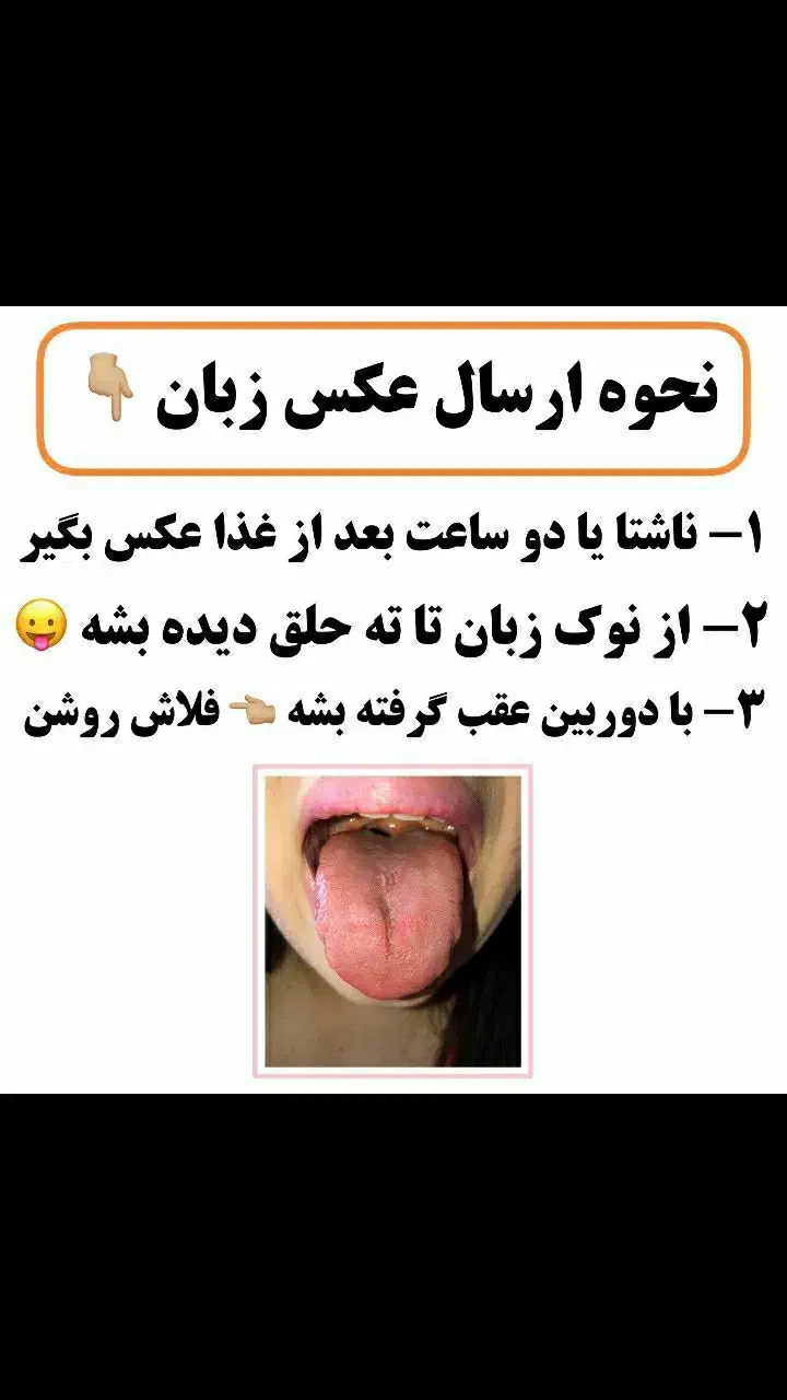 مشاوره رایگان زبان توسط استاد طب سنتی|خدمات آموزشی|گرگان, |دیوار