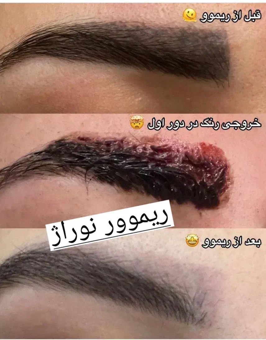 تخفیف ریمو تتو به مدت محدود|خدمات آرایشگری و زیبایی|تهران, تهرانپارس غربی|دیوار