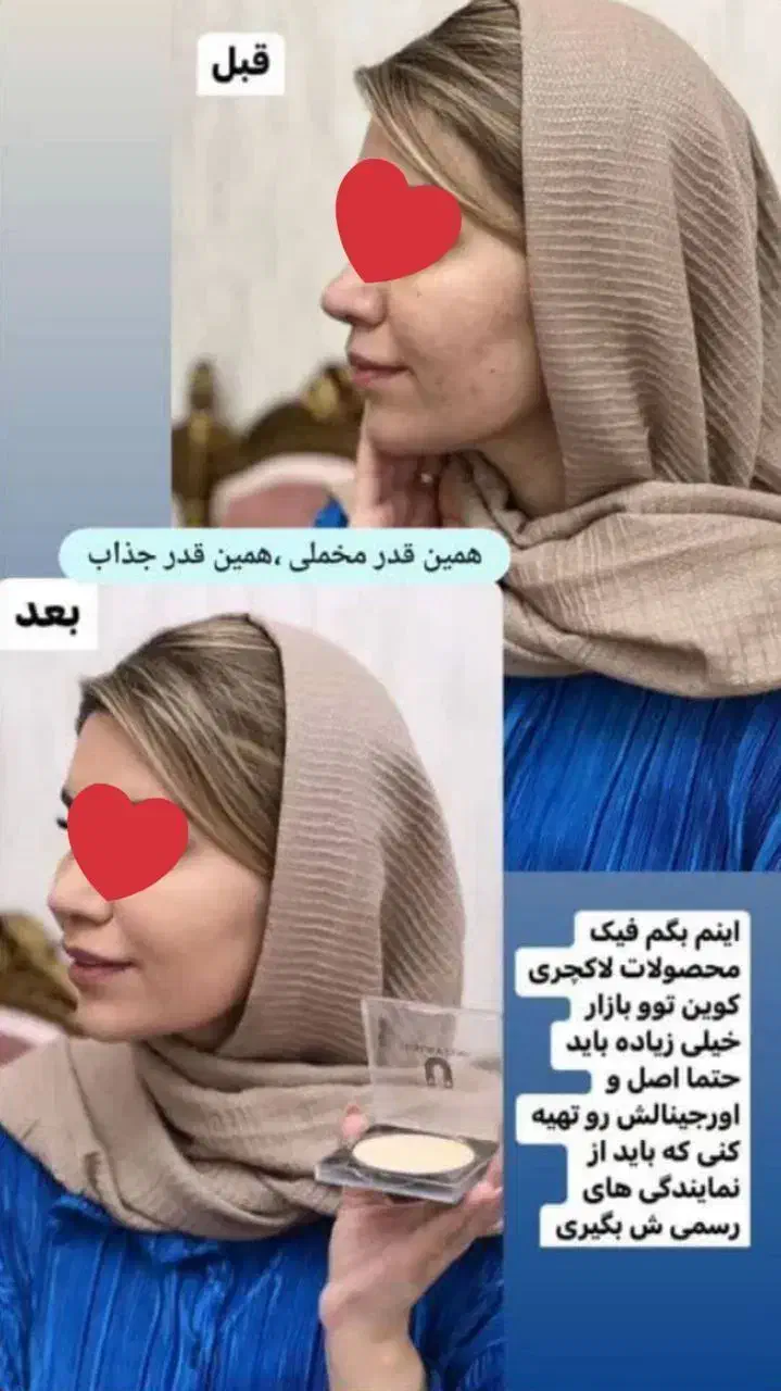 پنکک|آرایشی، بهداشتی، درمانی|ملکآباد, |دیوار