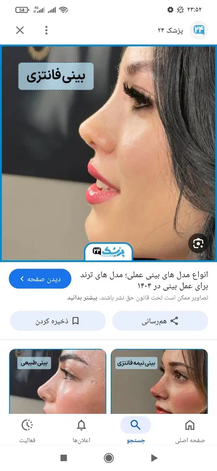 راهنمایی عمل بینی|فعالیت داوطلبانه|بیرجند, |دیوار