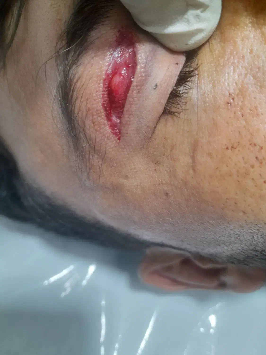 تزریقات وپانسمان در منزل|خدمات آرایشگری و زیبایی|نجفآباد, قدس|دیوار