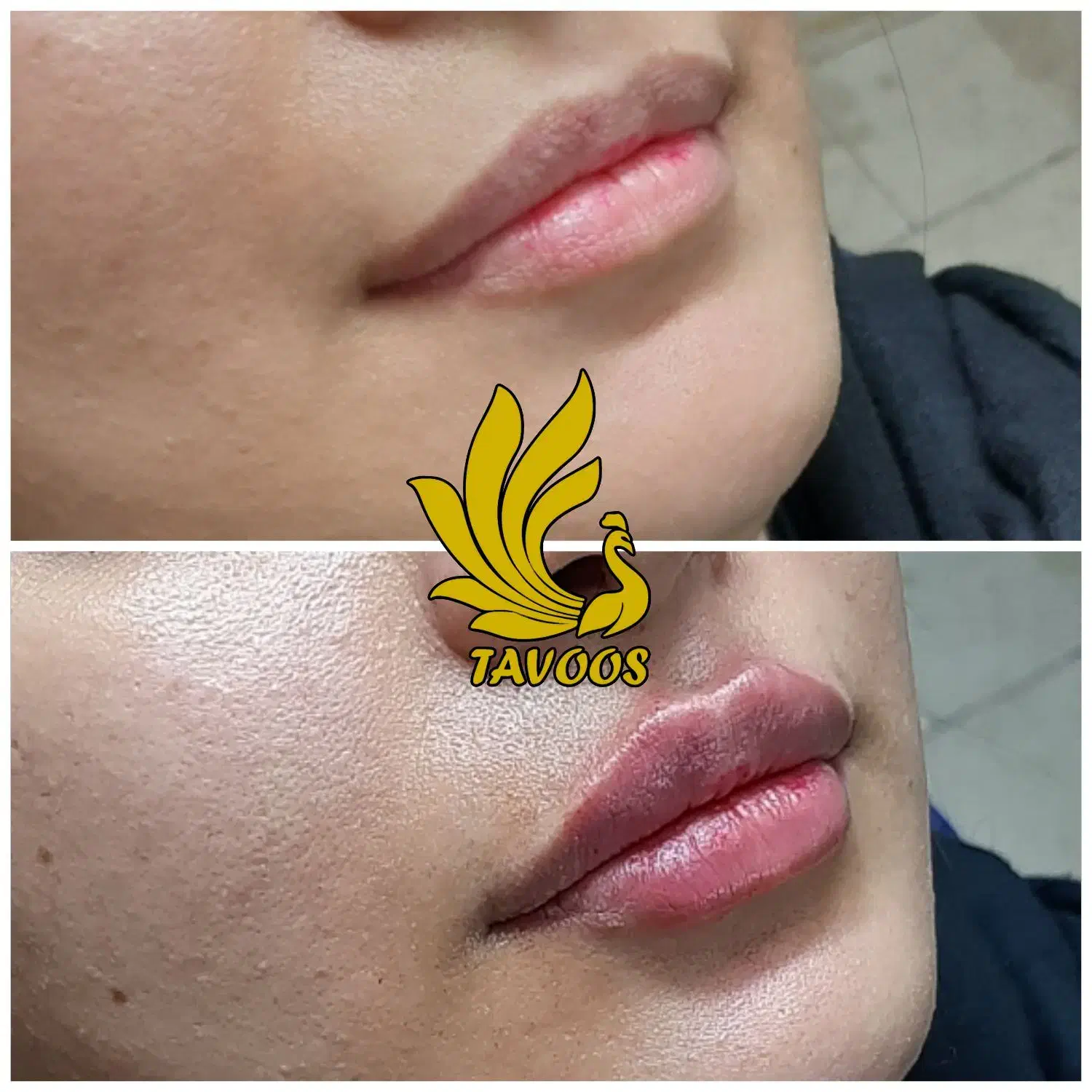 فیشیال مردانه تخصصی + بوتاکس و مزوتراپی|خدمات آرایشگری و زیبایی|رفسنجان, |دیوار