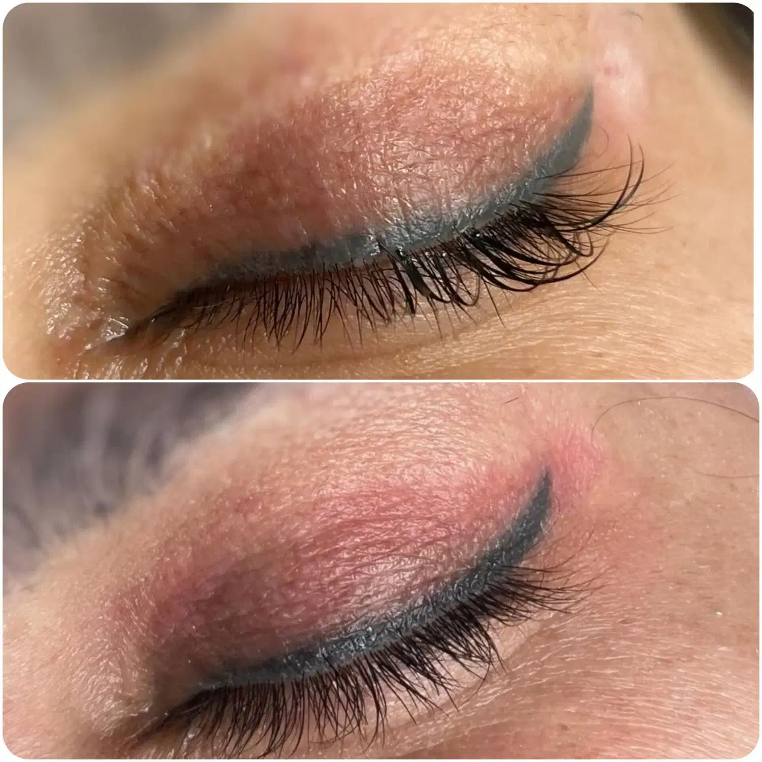 رفع اسکار بلفاروپلاستی بدون بازگشت|خدمات آرایشگری و زیبایی|اصفهان, چشمه باقرخان|دیوار