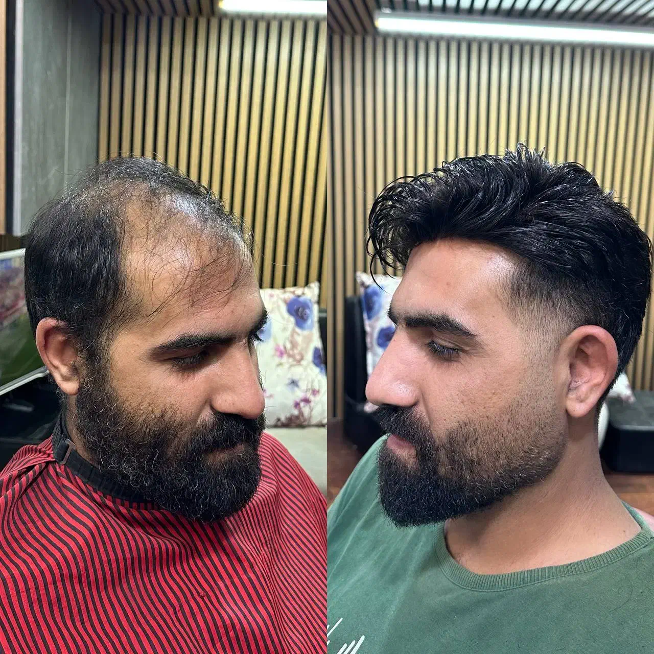 پروتزمو قم|خدمات آرایشگری و زیبایی|قم, زاد|دیوار