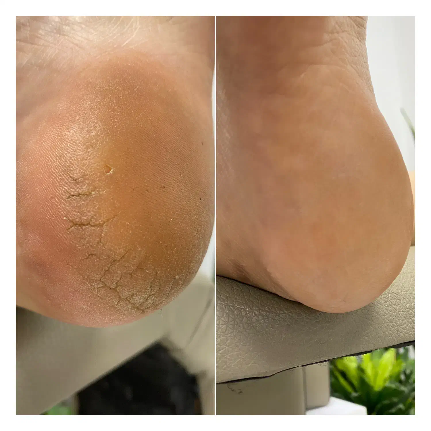 پدیکور درمانی و ریلکسی|خدمات آرایشگری و زیبایی|قائم‌شهر, |دیوار