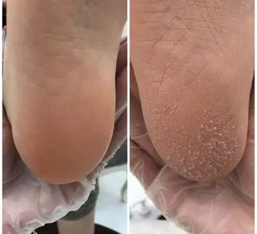 پدیکور پا در سهند با دستگاه تخصصی|خدمات آرایشگری و زیبایی|سهند, |دیوار