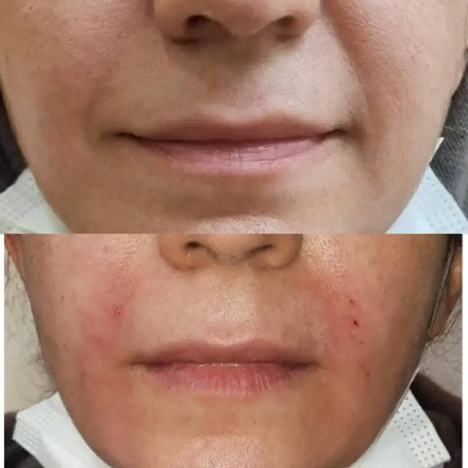 ژل لب 600|خدمات آرایشگری و زیبایی|ماهدشت, |دیوار