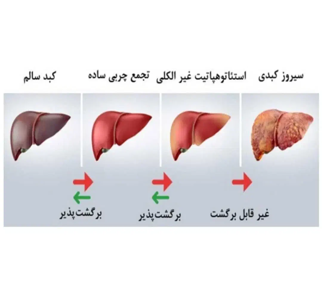 کبد پاک|آرایشی، بهداشتی، درمانی|اردبیل, |دیوار