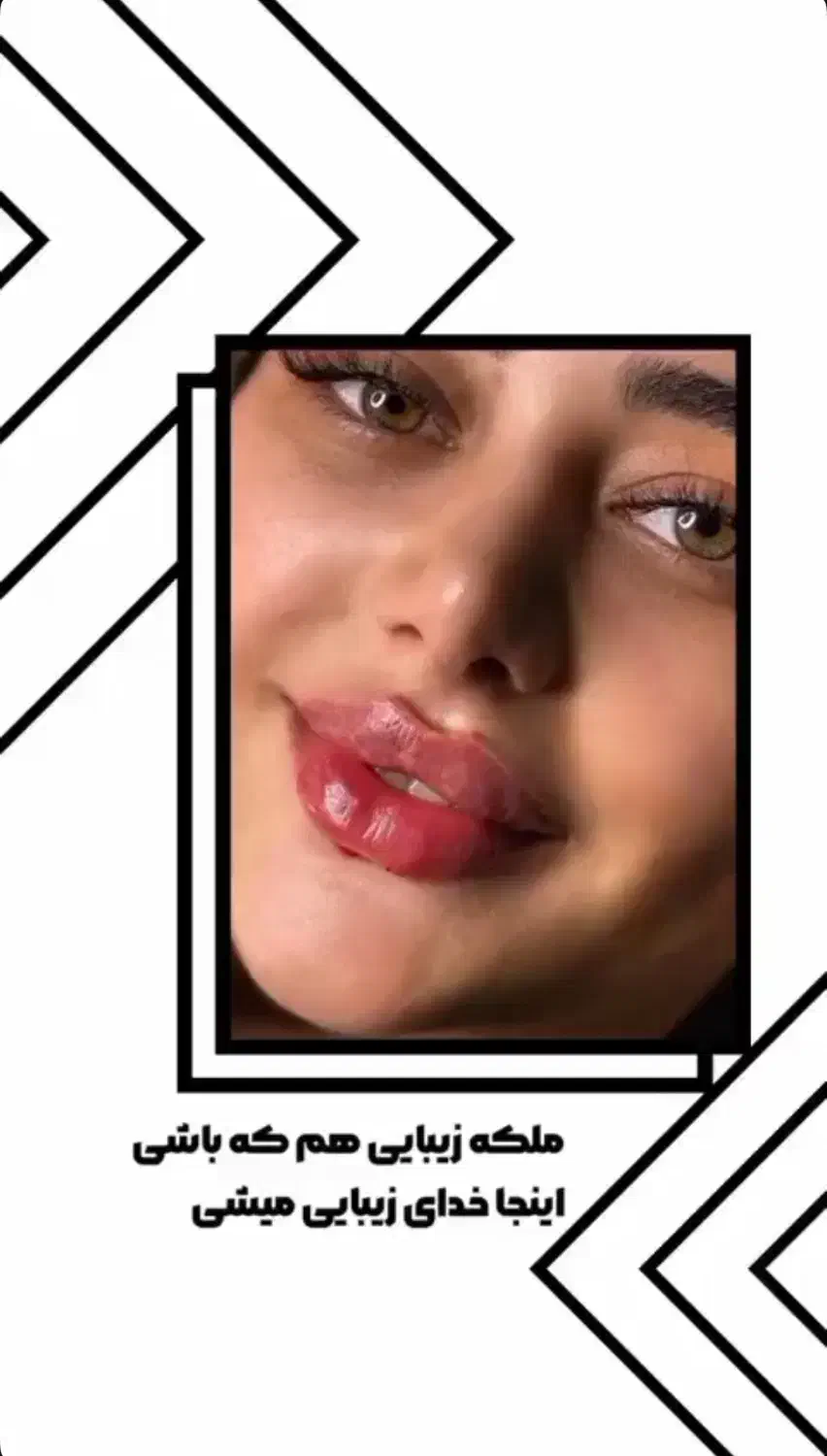 تخفیف ویژه خدمات ژل و بوتاکس|خدمات آرایشگری و زیبایی|زابل, |دیوار