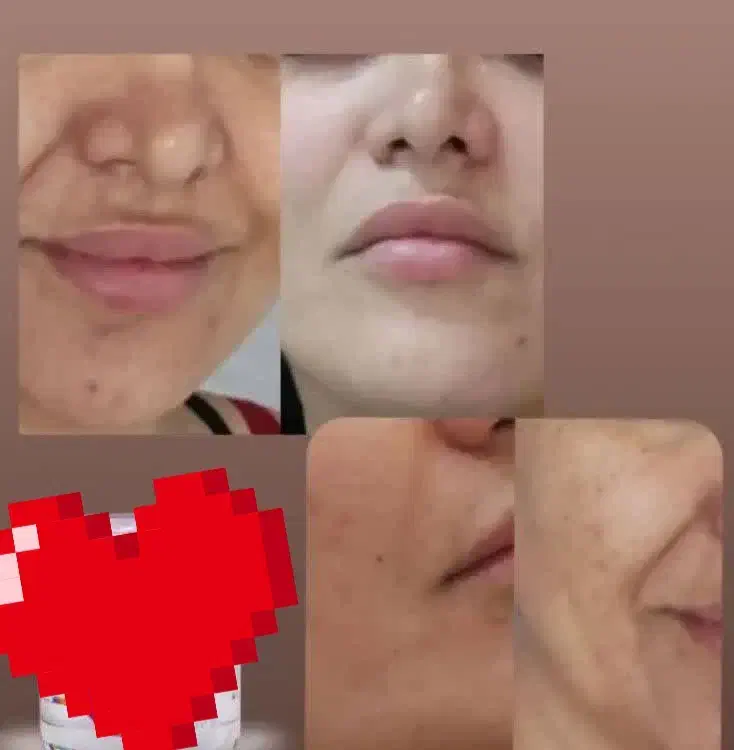 دوست داری پوستت را ۱۰ سال جوانتر کنی|آرایشی، بهداشتی، درمانی|لاهیجان, کوی خزر|دیوار