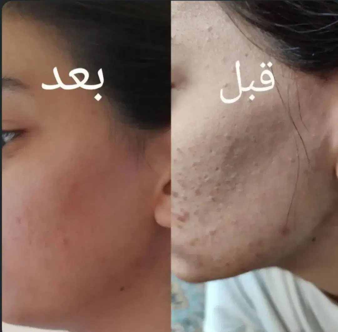 فشیال|خدمات آرایشگری و زیبایی|محمدشهر, محمدشهر|دیوار