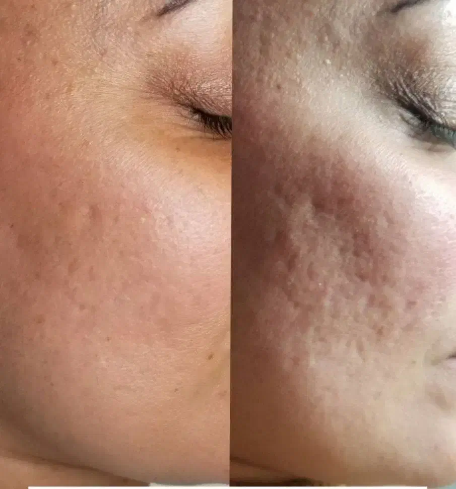 پوست و موی زیبا|آرایشی، بهداشتی، درمانی|ساری, |دیوار