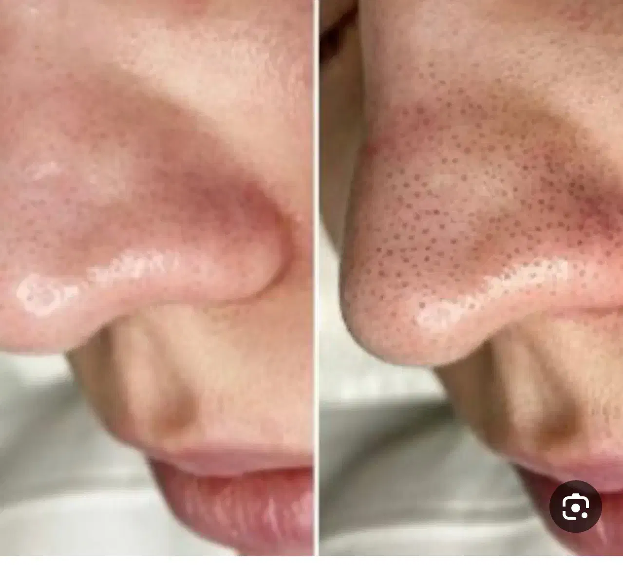 فشیال تخصصی vip پوست به مدت 3 روز فقط 170 تومن|خدمات آرایشگری و زیبایی|مشهد, آزادشهر|دیوار