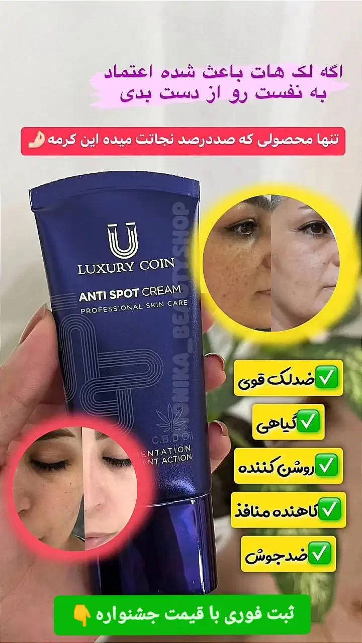ضدلک اصل فرانسوی|حراج|قم, زنبیل آباد|دیوار