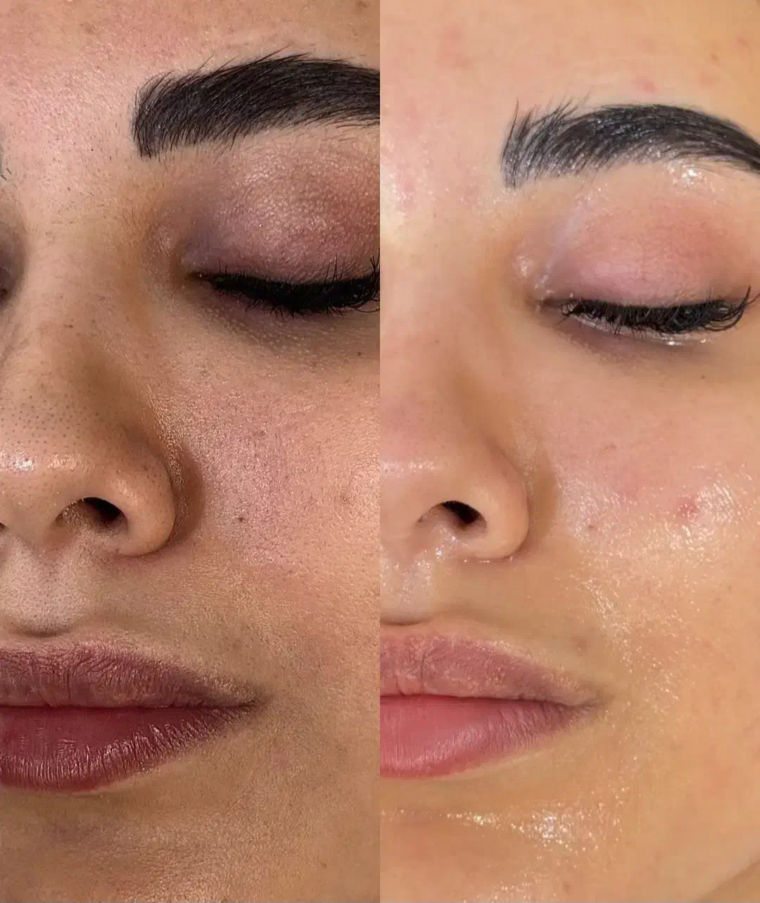 فیشال و(پاکسازی پوست)آبرسانی پوست|خدمات آرایشگری و زیبایی|رفسنجان, |دیوار