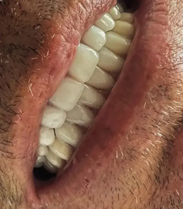 دندان سازی|پزشکی|ارومیه, |دیوار