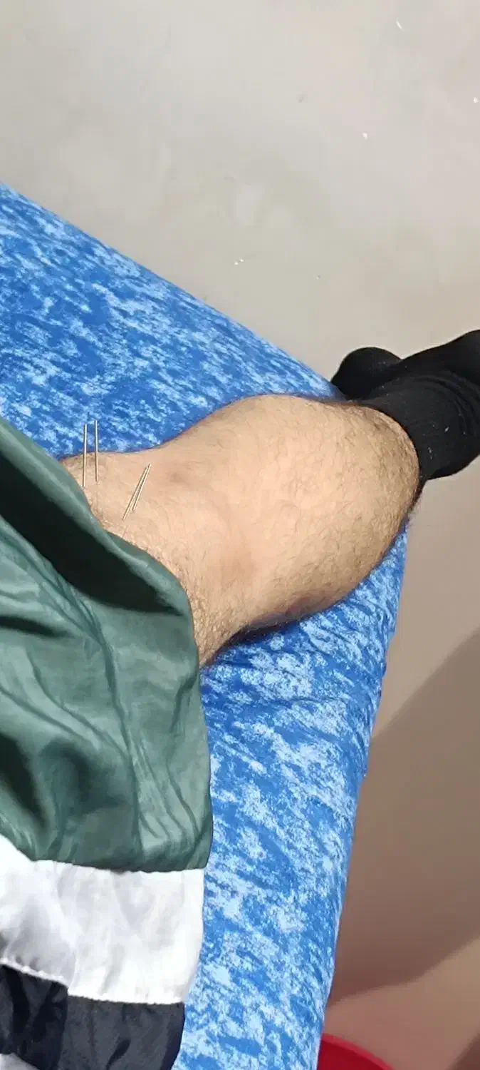 کمک برای سیاتیک|فعالیت داوطلبانه|مشهد, الهیه|دیوار