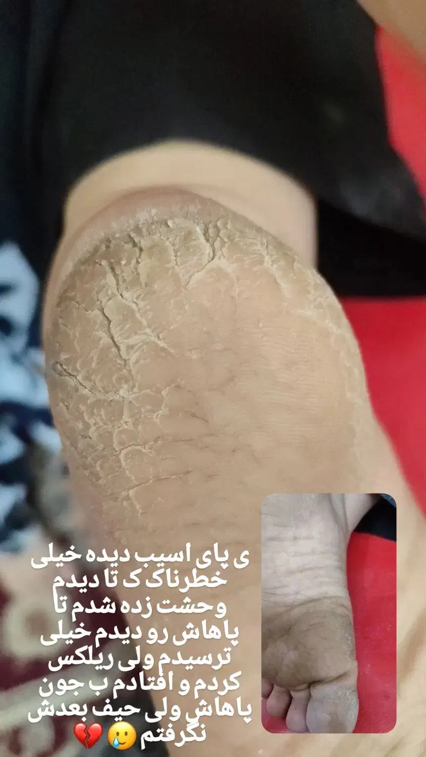 پدیکور و رفع سیاهی قوزک پا و جوانسازی دست|خدمات آرایشگری و زیبایی|برازجان, |دیوار