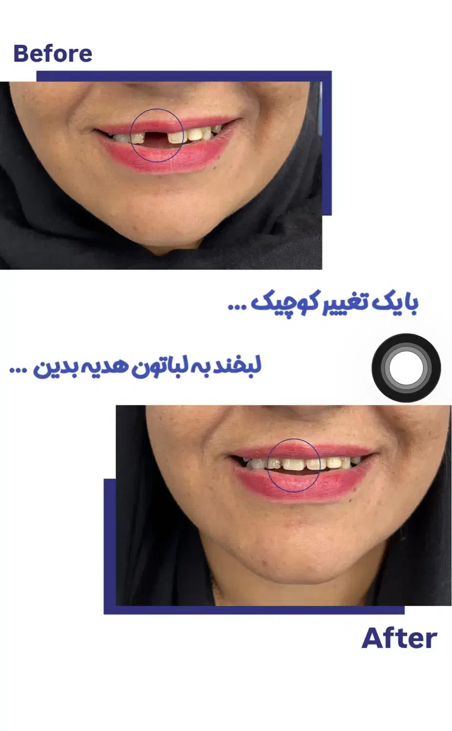 بلک فرایدی دندان مصنوعی دندانسازی اقساط بیمه ها|خدمات آرایشگری و زیبایی|کرمان, |دیوار