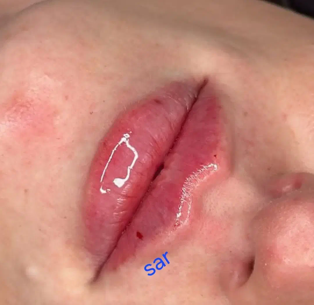 تزریق وآموزش تزریق ژل وبوتاکس ۲۵۰۰|خدمات آرایشگری و زیبایی|اهواز, طالقانی|دیوار