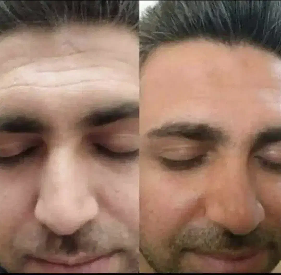 کرم  ضد لک و سفید کننده تضمینی|آرایشی، بهداشتی، درمانی|کیش, |دیوار