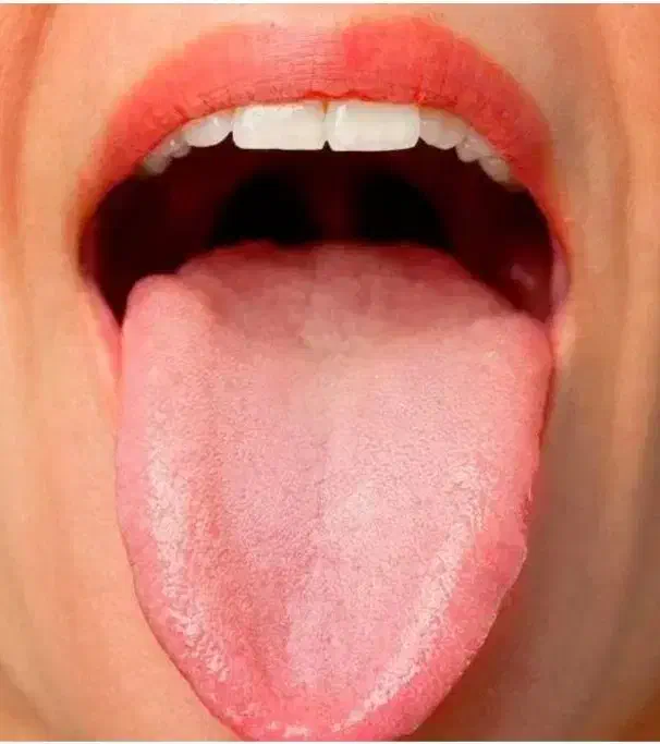 تشخیص بیماری ها از روی زبان و درمان به صورت سنتی|فعالیت داوطلبانه تحقیقاتی|تبریز, |دیوار