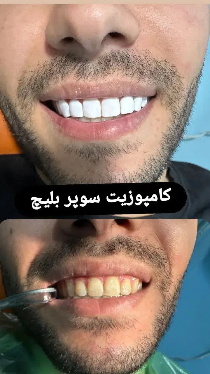 دندانپزشکی|خدمات آرایشگری و زیبایی|تهران, خاک سفید|دیوار