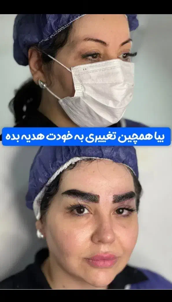 کاشت مو وزیبایی بدن اقساطی|خدمات آرایشگری و زیبایی|تبریز, |دیوار