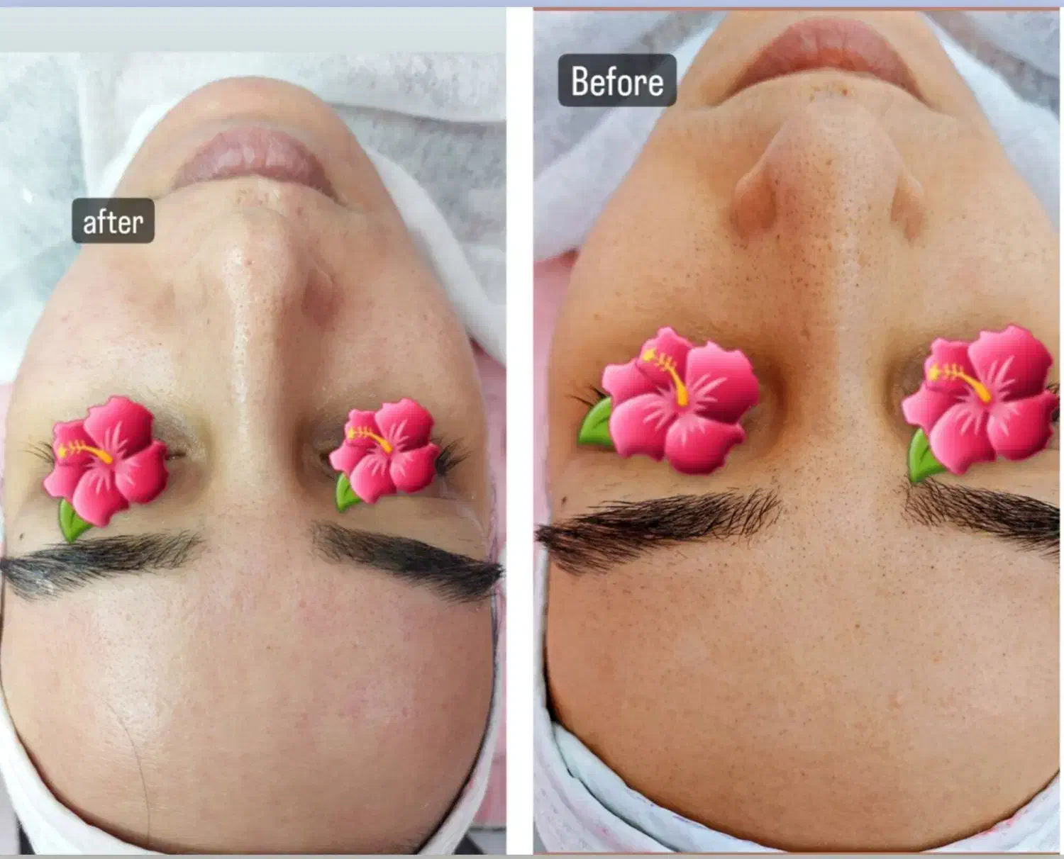 فیشال تخصصی پوست|خدمات آرایشگری و زیبایی|محمدشهر, محمدشهر|دیوار