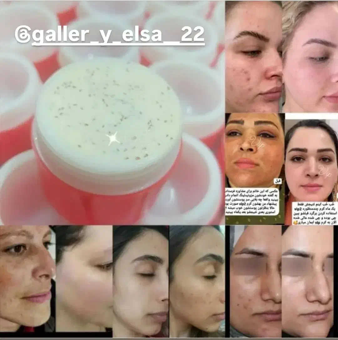 کرم سفید کننده صددرصد تضمینی|آرایشی، بهداشتی، درمانی|زابل, |دیوار