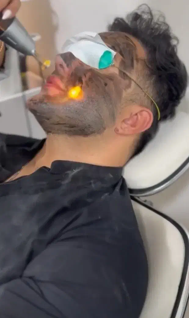 لیزر(خانم ها)۳۰۰لیزر(آقایان )۶۰۰و لیزر فوتونا۱۲۰۰|خدمات آرایشگری و زیبایی|نجفآباد, باغ ملی|دیوار