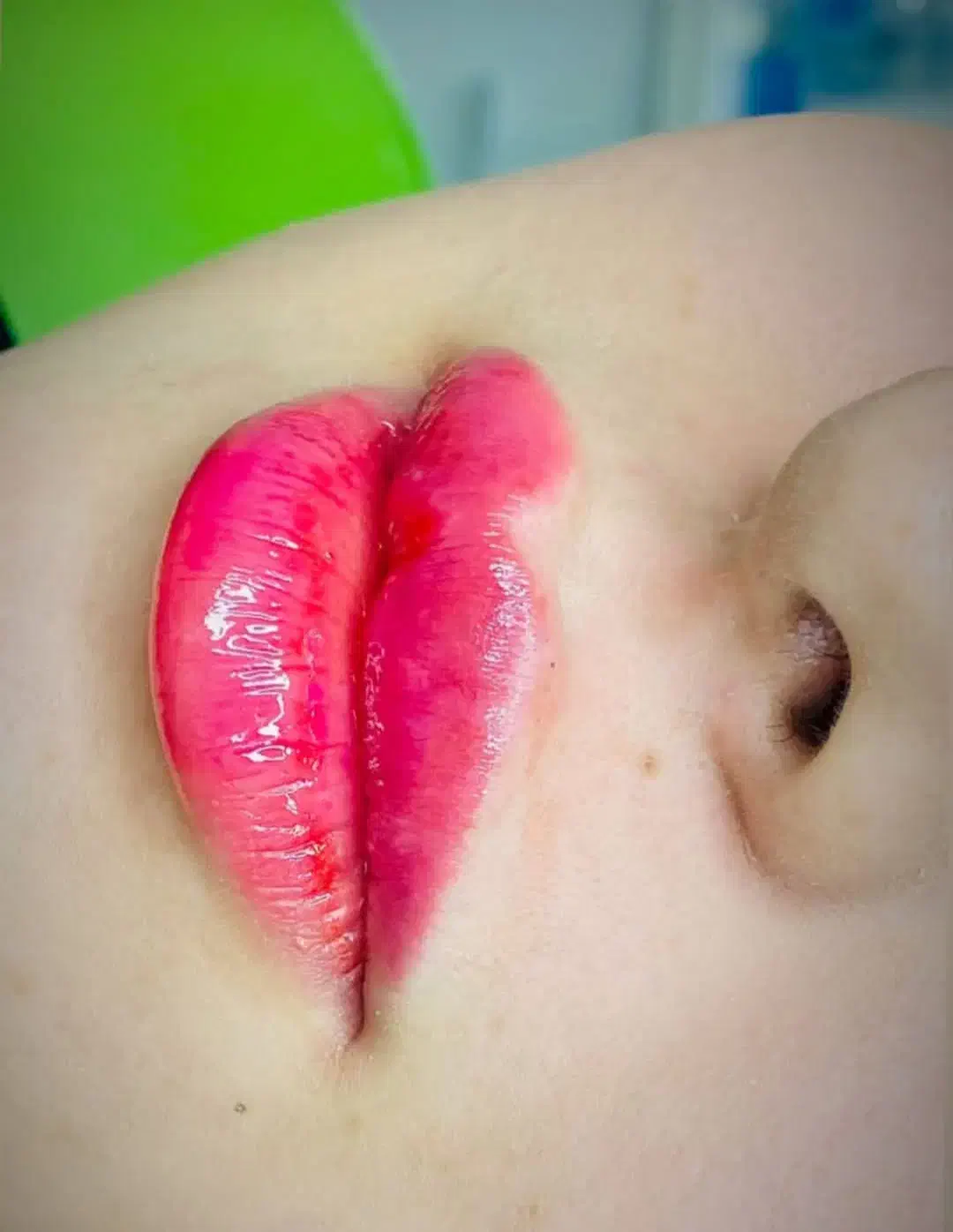 اف ویژه تمام خدمات زیبایی و جراحی در مطب|خدمات آرایشگری و زیبایی|یاسوج, |دیوار