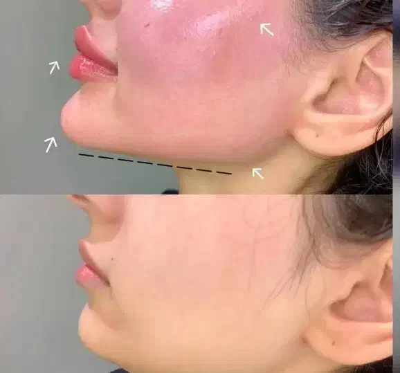 ژل و بوتاکس باقیمت استثنایی|خدمات آرایشگری و زیبایی|بروجرد, |دیوار