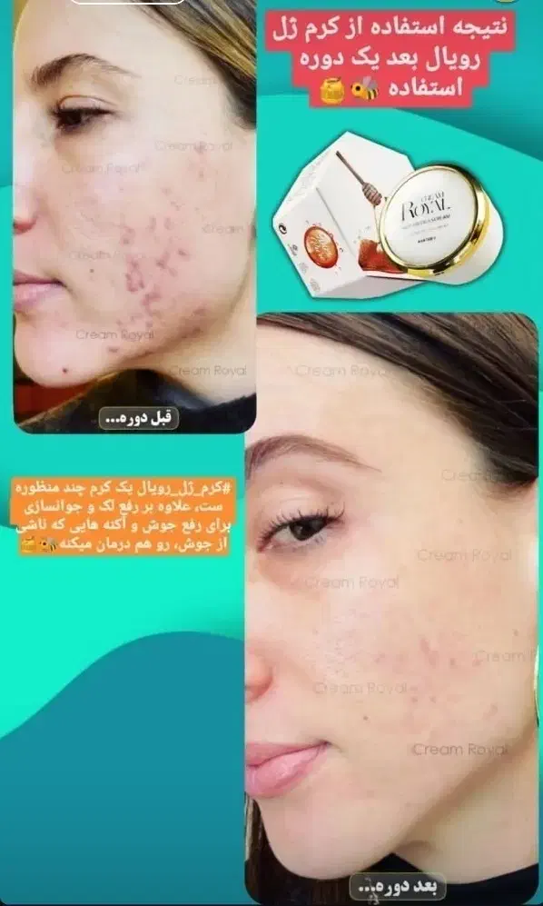 کرم رویال وصابون|آرایشی، بهداشتی، درمانی|لردگان, |دیوار