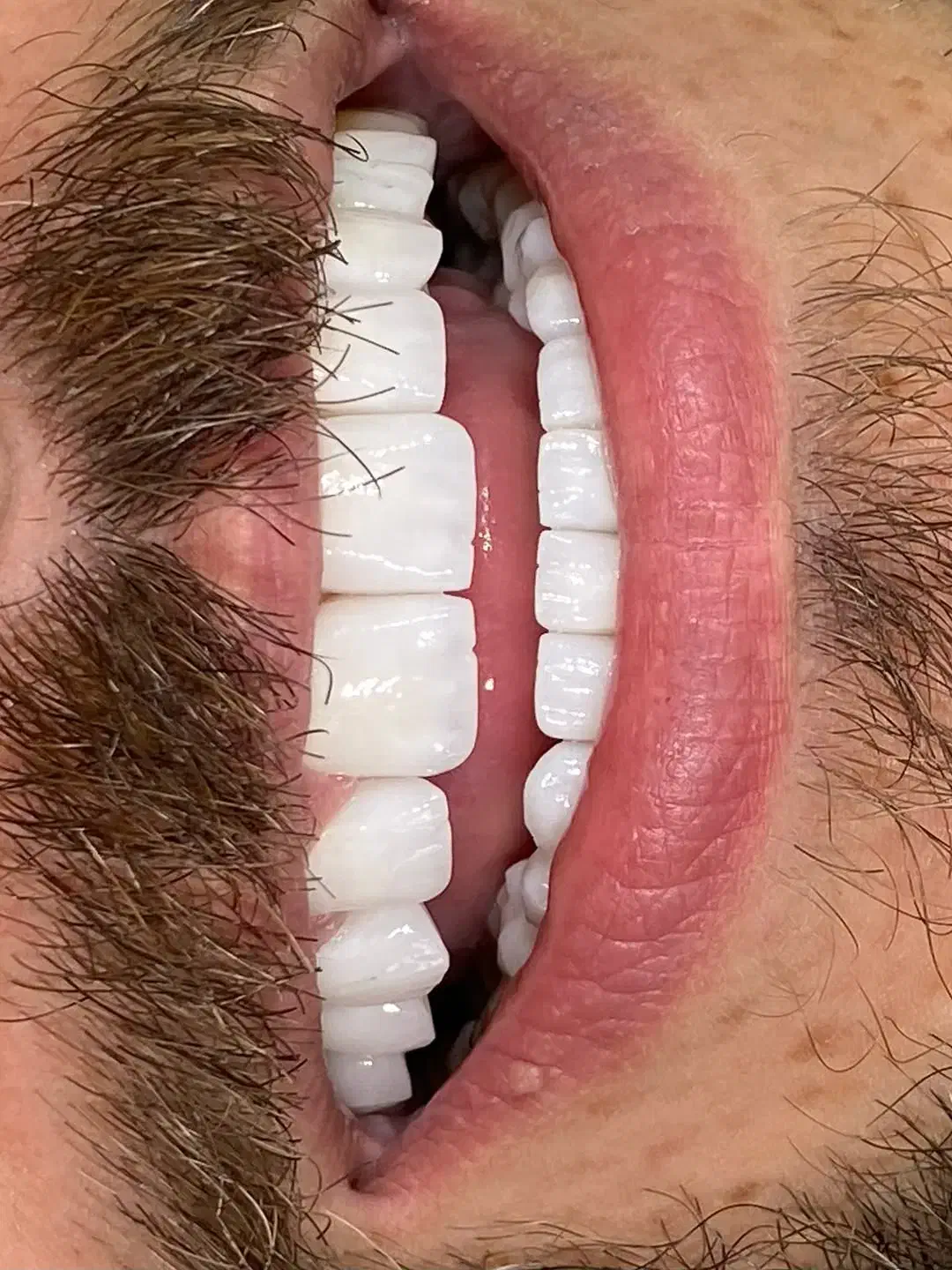 کامپوزیت|پزشکی|خرم‌آباد, |دیوار