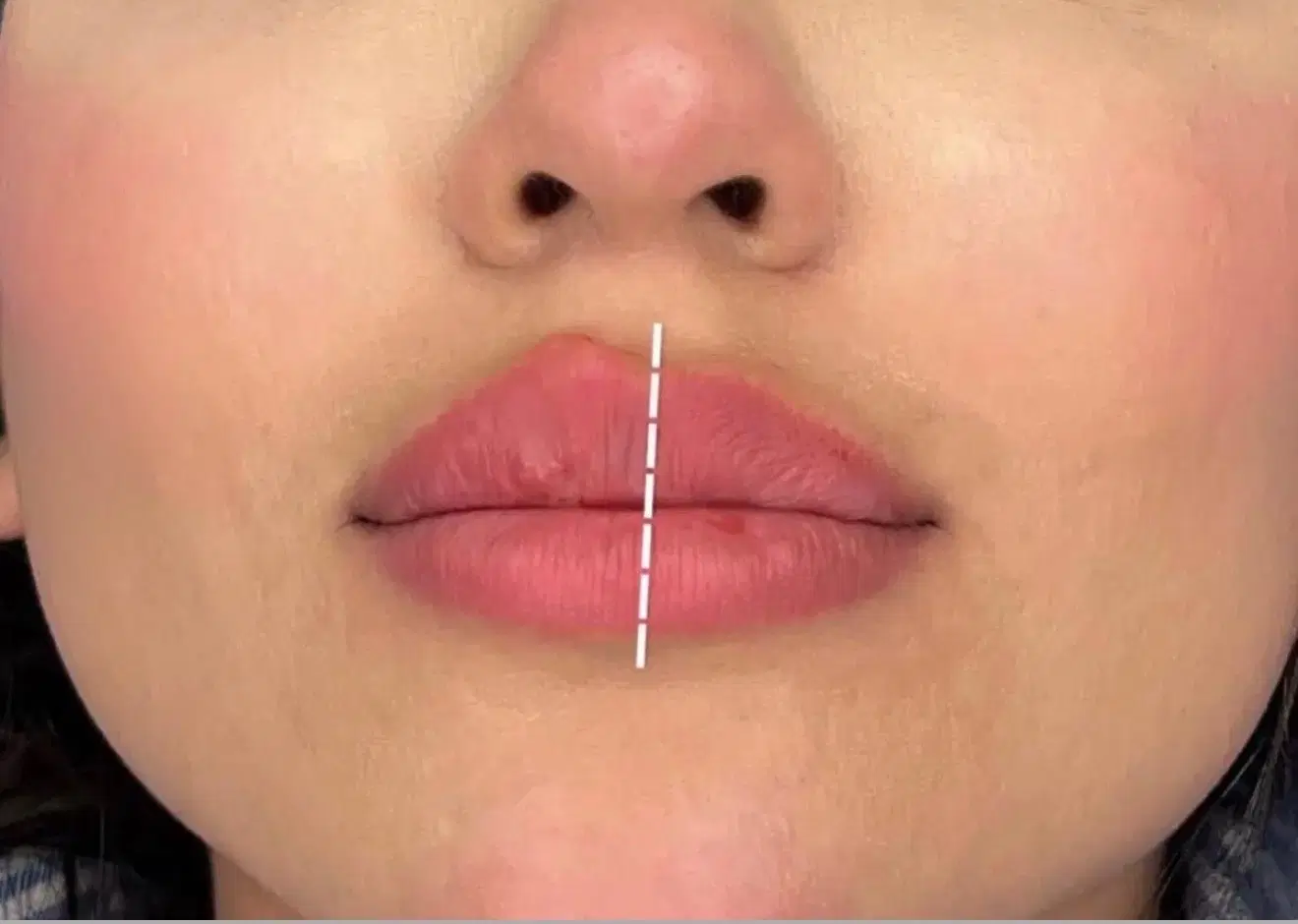 مدل برای تزریق ژل لب هر سی سی ۶۷۰ فقط|خدمات زیبایی و سلامت|تهران, سلسبیل جنوبی|دیوار