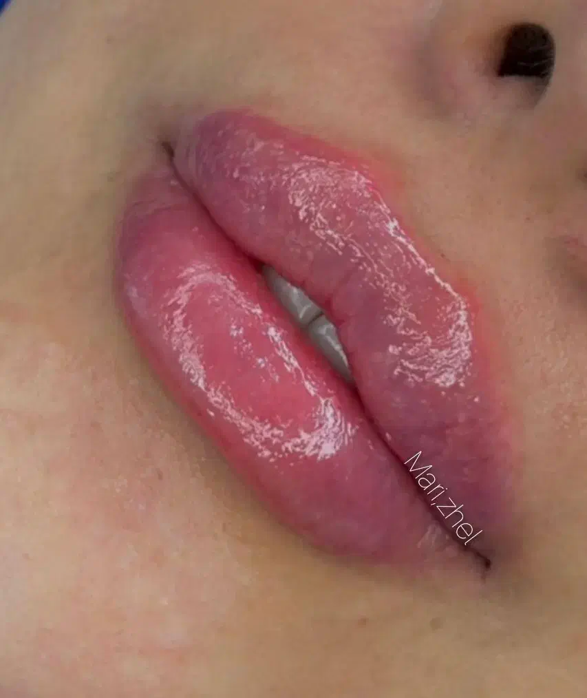 تزریق ژل بوتاکس چال گونه تتو پرسینگ مژه و اموزش|خدمات آرایشگری و زیبایی|اهواز, معین زاده|دیوار